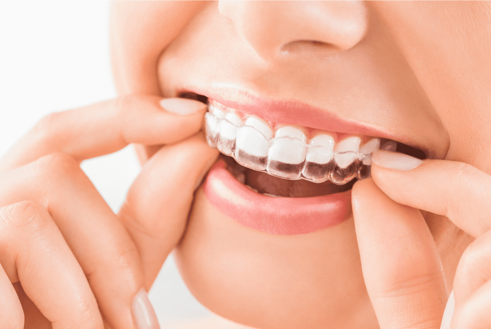 Does Invisalign Hurt?  Hampstead Orthodontic Practice