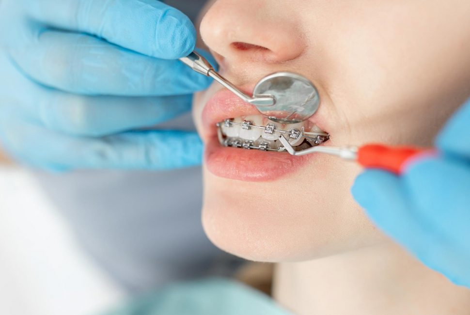 Young woman getting her broken braces fixed by an orthodontist